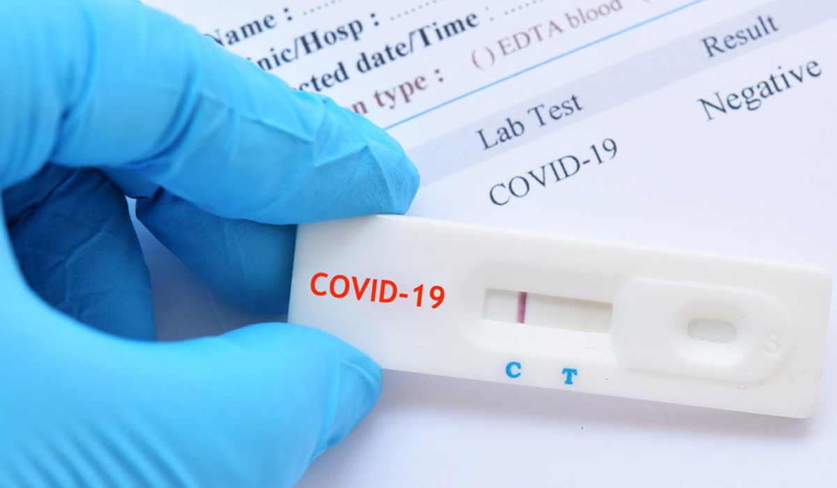 Rapid Antigen Test